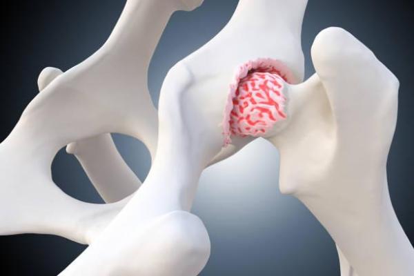 Pourquoi mon chien hurle de douleur - Arthrite