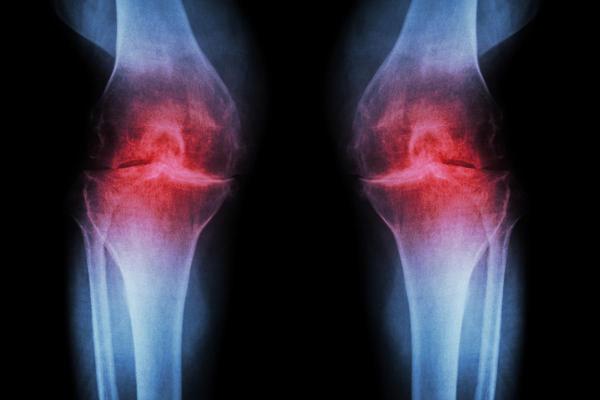 Pourquoi mon chien hurle de douleur - Arthrose