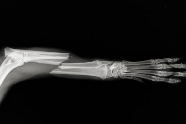 Pourquoi mon chien hurle de douleur - Fractures